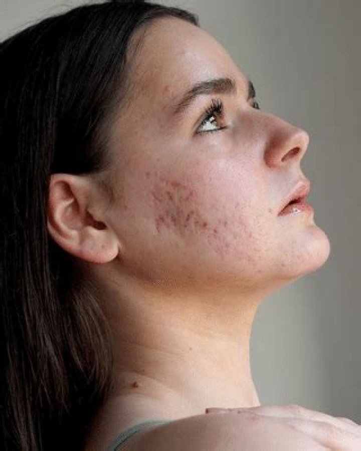 How to learn to love your skin